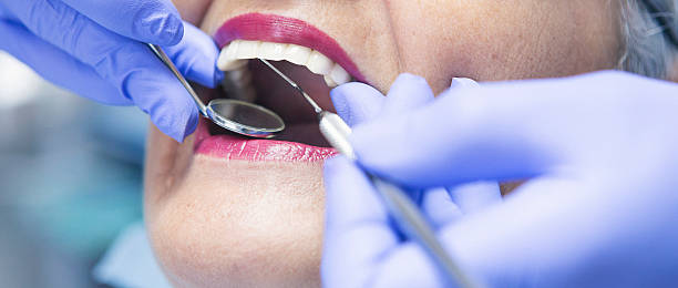 Best Chipped Tooth Repair Near Me  in Tennessee Ridge, TN